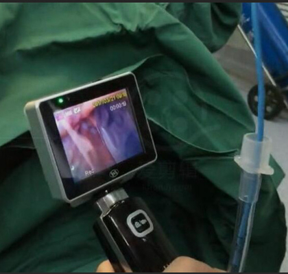 Einzelne Gebrauchs-Intubations-Videokehlkopfspiegel ICU EMS mit der 1280 x 720 Kamera-Entschließung