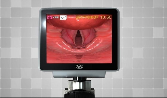 FASER-Optikvideokehlkopfspiegel HYHJ 1320 Plastikmetallmit Wegwerfblättern