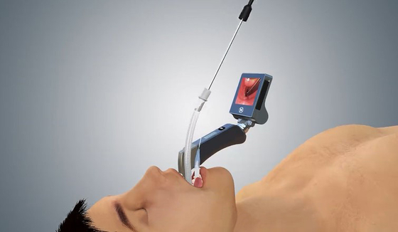 5 Mac Miller Blades Medical Digital Video Kehlkopfspiegel mit ergonomischem Handschaft