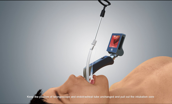 Tragbares HD-USB-Videolaryngoskop für Erwachsene und Kinder Haiye Medical