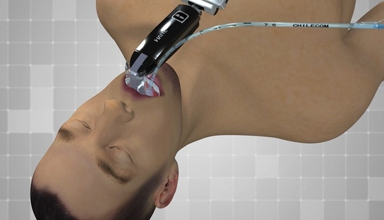 FDA bestätigte 3,0 Anzeige tragbarer Endoscope USB-Ertrag-Videokehlkopfspiegel