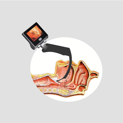 CMOS-Intubations-Handvideolaryngoskop mit 70 Grad hyperangulierter Glottis-Visualisierung