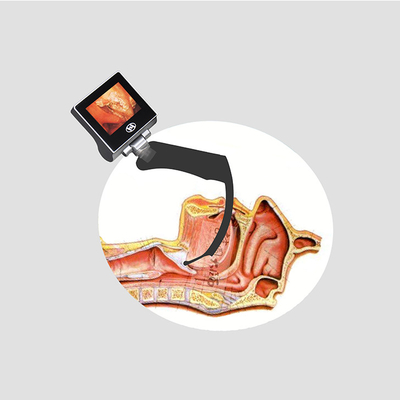 Tragbarer Hand-Videokehlkopfspiegel USB 32GB Reuable der hohen Auflösung