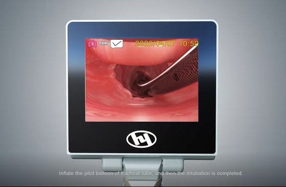 HYHJ-KC Medizinisch-Grad-Metallmaterielles Digital-Antinebel-Kamera-System-Videokehlkopfspiegel
