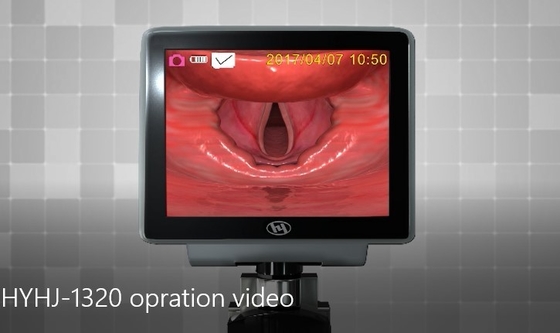 Operationsraum-pädiatrische Intubations-Videokehlkopfspiegel kein blinder Fleck