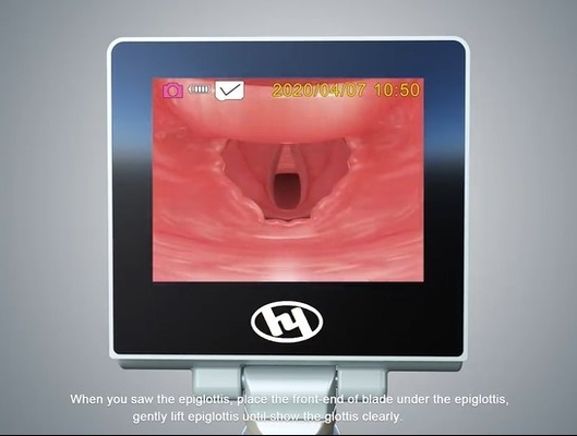 Intubations-Gerät-Videokehlkopfspiegel HYHJ-KC des Video-960*480