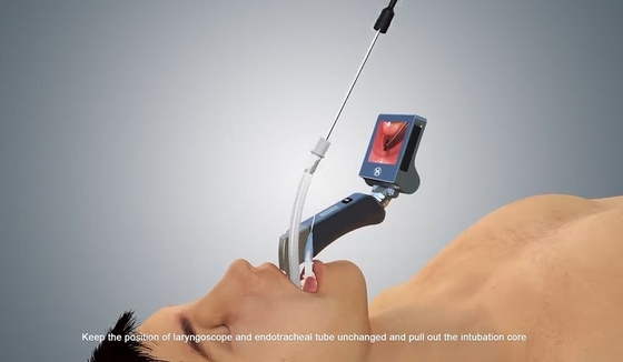 Wieder aufladbares wiederverwendbares Blatt-Videokehlkopfspiegel für medizinische Anästhesie-Intubation